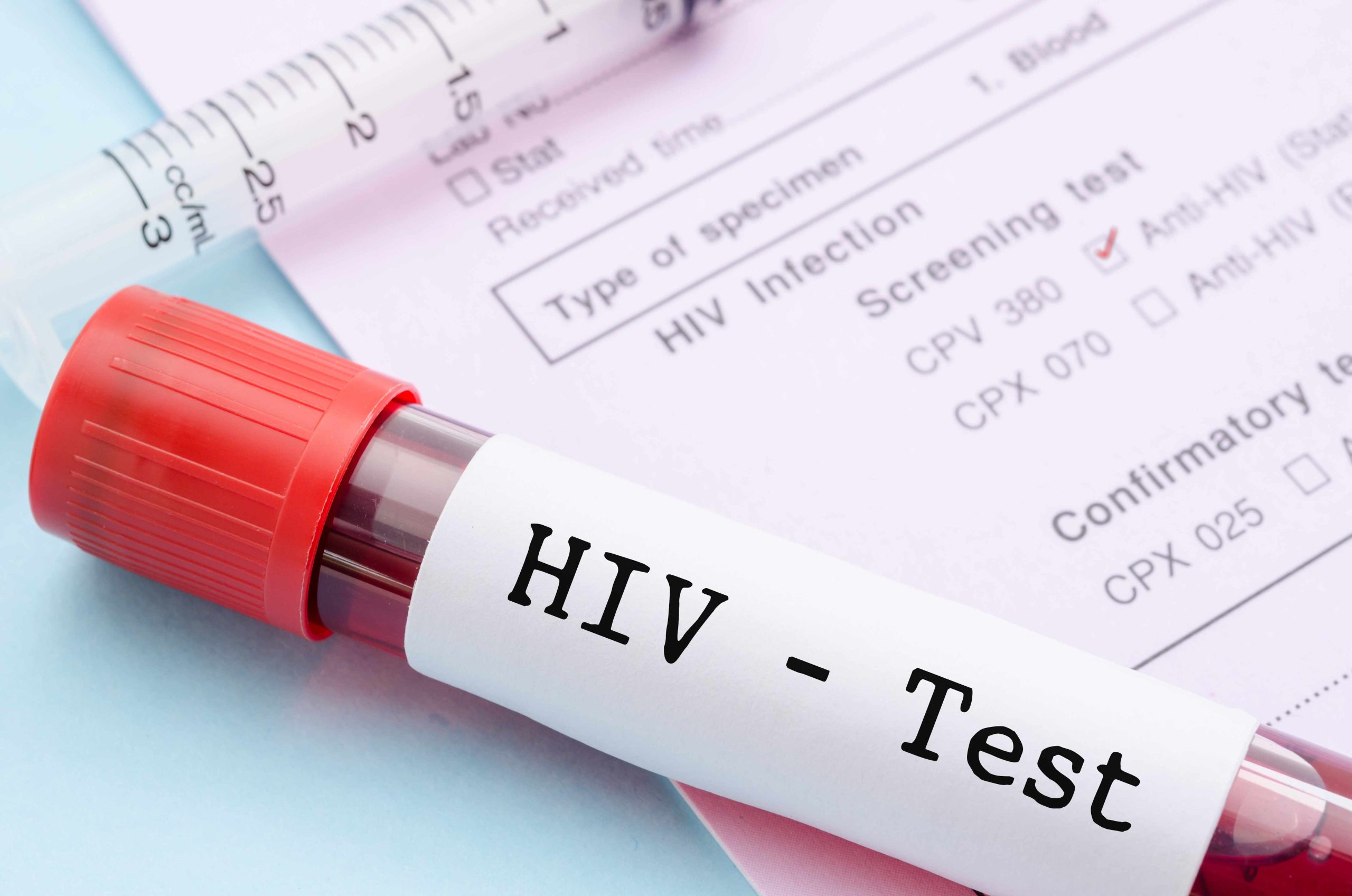 Hiv, crescono le infezioni: l’appello di Anlaids a fare il test, anche senza sintomi